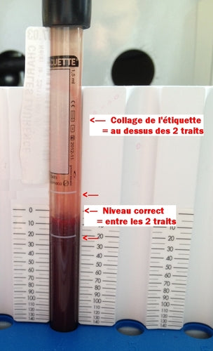 Tube VS